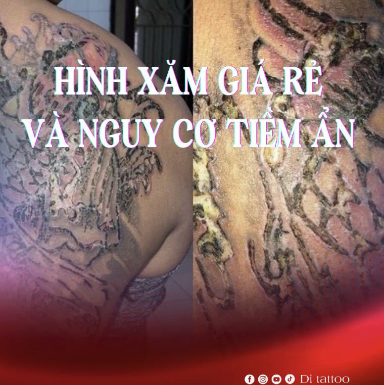 nguy cơ của xăm hình giá rẻ